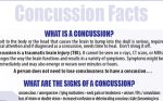 Free Concussion Fact Sheet
